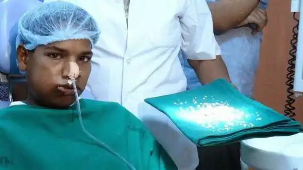 Photos: India Doctors Remove 232 Teeth from Boy